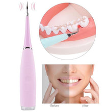 Load image into Gallery viewer, THEIGNITIC™ PORTABLE ELECTRIC SONIC DENTAL SCALER TOOTH CALCULUS REMOVER TOOTH STAINS TARTAR TOOL DENTIST WHITEN TEETH HEALTH HYGIENE WHITE (TEETH WHITING BLUE)
